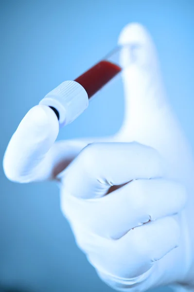 Toma de sangre con la mano en el tubo de ensayo con filtro azul — Foto de Stock