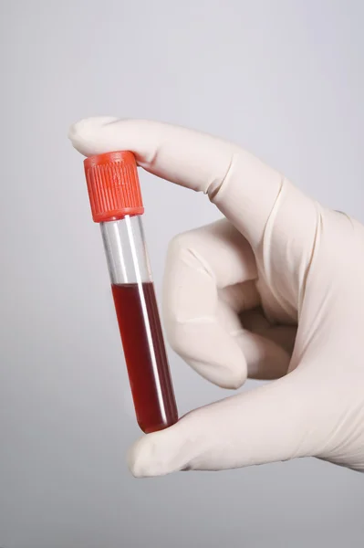 Mano sosteniendo sangre en tubo de ensayo — Foto de Stock