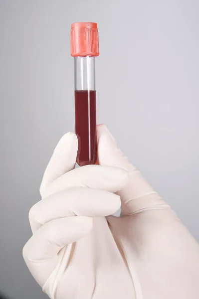 Mano sosteniendo sangre en tubo de ensayo —  Fotos de Stock
