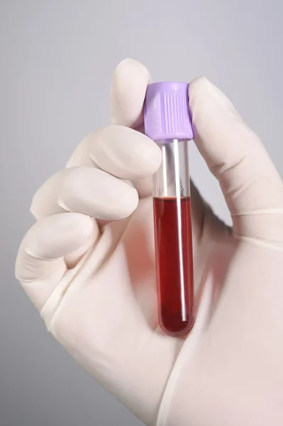 Mão segurando sangue no tubo de teste — Fotografia de Stock