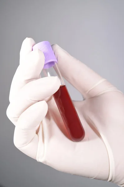 Tenere il sangue in provetta — Foto Stock