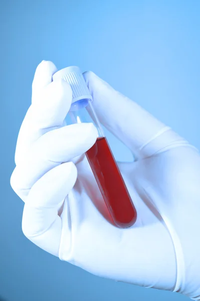 Hand hält Blut im Reagenzglas mit blauem Filter — Stockfoto