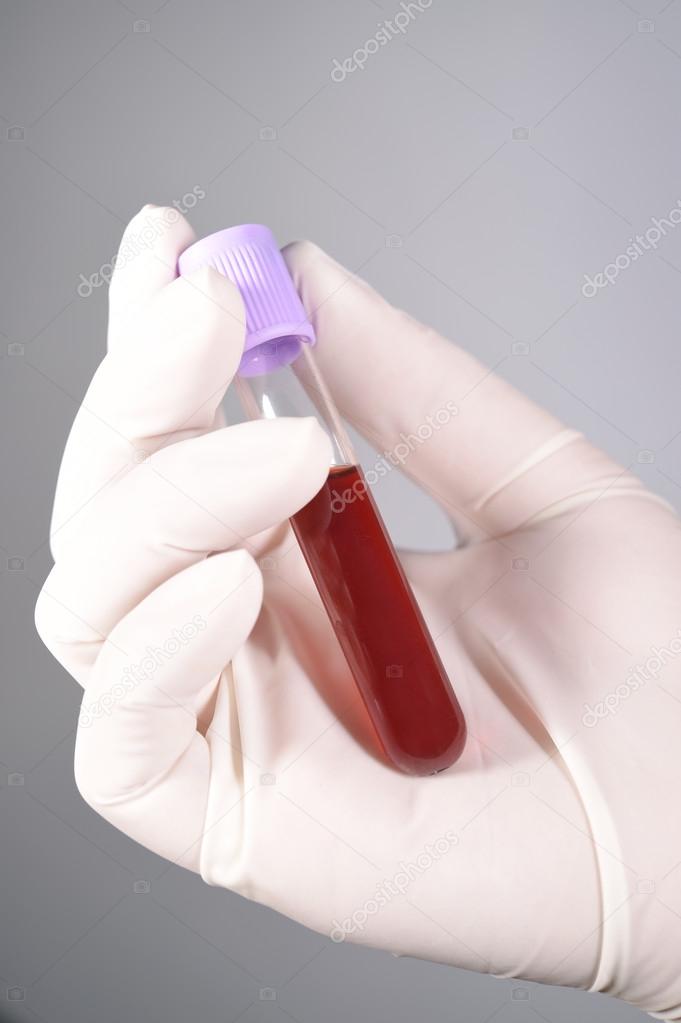 Hand holding blood in test tube