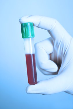 El kan tüp almak mavi filtre ile tutarak.