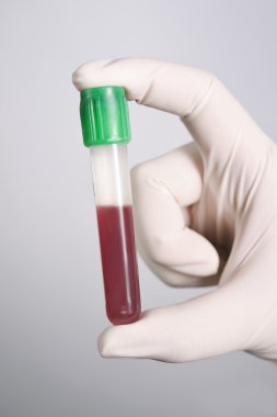 el kan test tüpü içinde tutarak