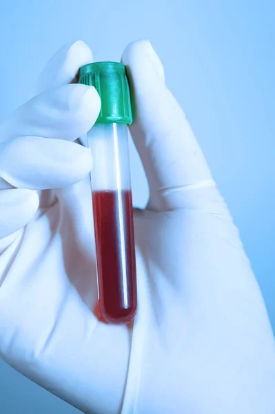 Mão segurando sangue em tubo de ensaio tomar com filtro azul — Fotografia de Stock