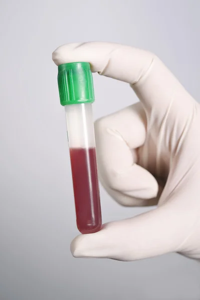 Mão segurando sangue no tubo de teste — Fotografia de Stock