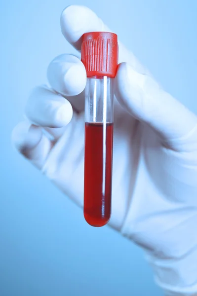 Hand holding blood in test tube take with blue filter — Stock Photo, Image