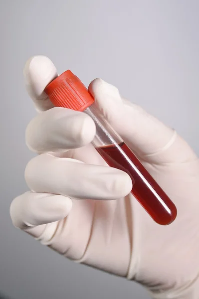 Mano sosteniendo sangre en tubo de ensayo — Foto de Stock