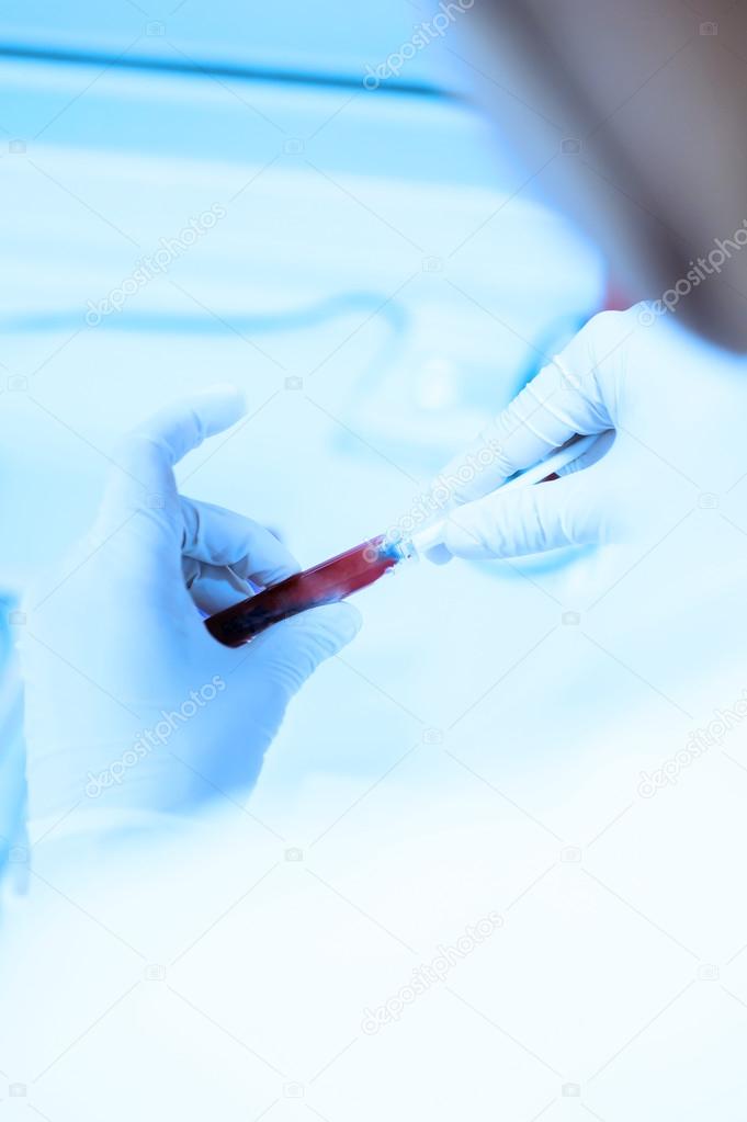 Scientist working at the blood laboratory