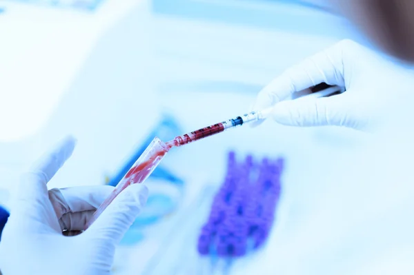 Naukowiec pracujący w laboratorium krwi — Zdjęcie stockowe