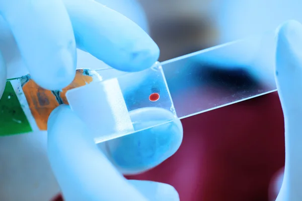 Análisis de sangre en laboratorio — Foto de Stock