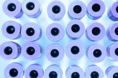 kan laboratuarda test