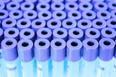 kan laboratuarda test