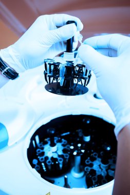 kan laboratuarda test