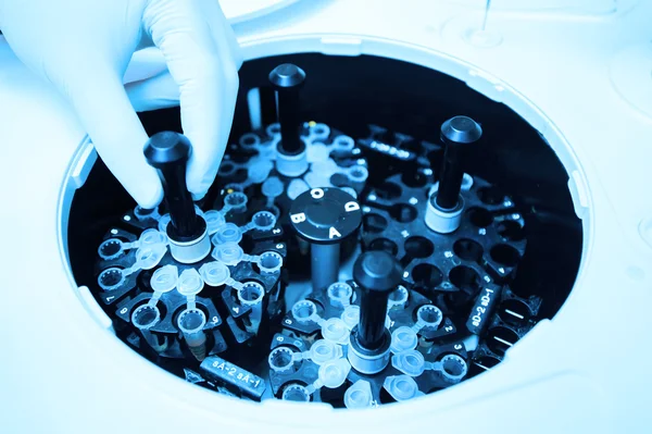 Blood testing in laboratory — Stock Photo, Image