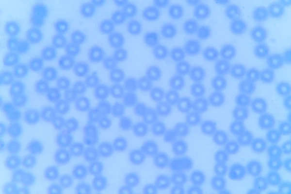 Kan yayması: kırmızı kan hücreleri mikroskop altında — Stok fotoğraf