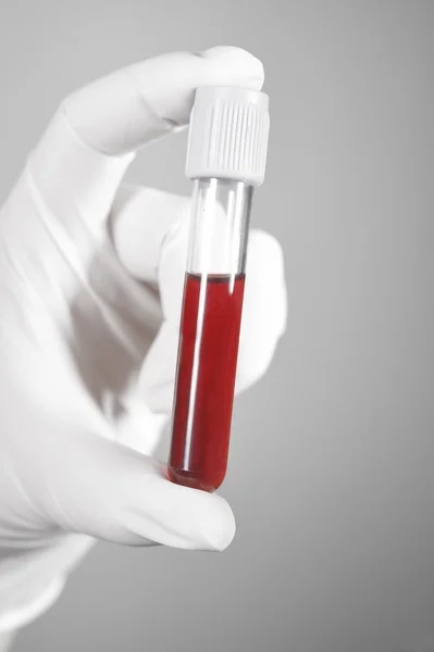 Tubo per analisi del sangue in laboratorio — Foto Stock