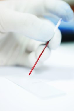 kan laboratuarda test