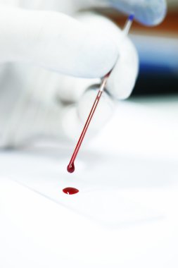 kan laboratuarda test