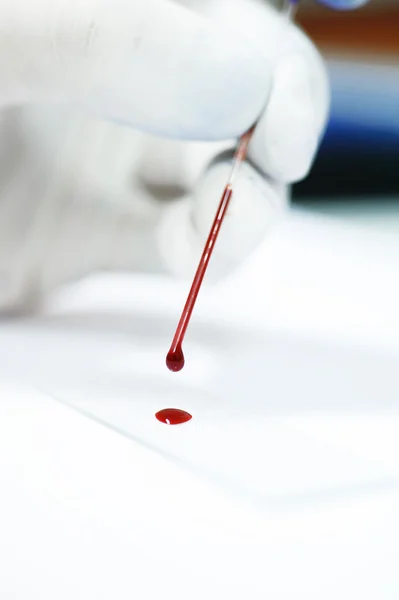 Blodprøve i laboratorium – stockfoto