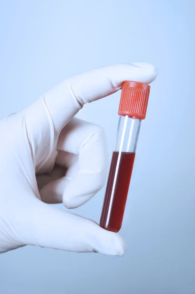 Probówki krwi w laboratorium — Zdjęcie stockowe