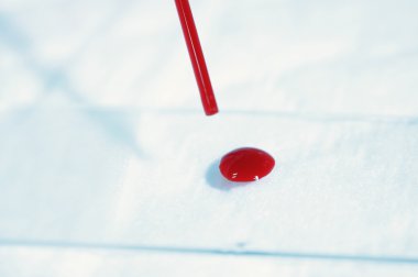 kan laboratuarda test