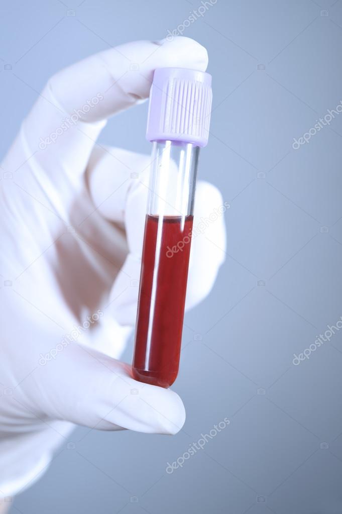 Hand holding blood in test tube