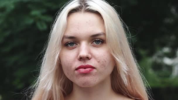 Porträtt av en ung flicka med problem hud i ansiktet — Stockvideo
