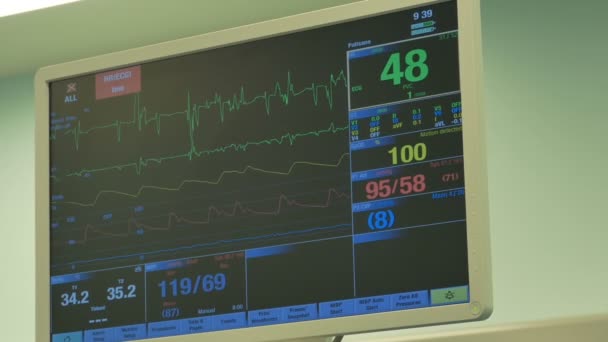 Monitor ECG en el quirófano — Vídeo de stock