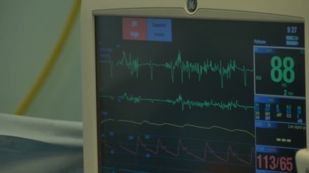 Медицинский монитор избиения сердца — стоковое видео
