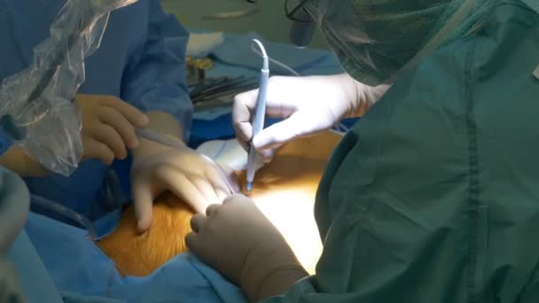 Chirurgien opération cardiaque — Video