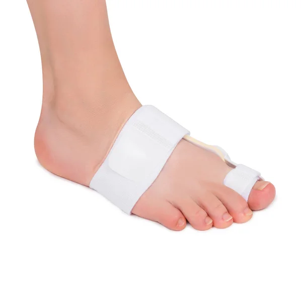 有一个大脚趾的股骨矫正器的雌性脚 Bunion Relief Protector — 图库照片