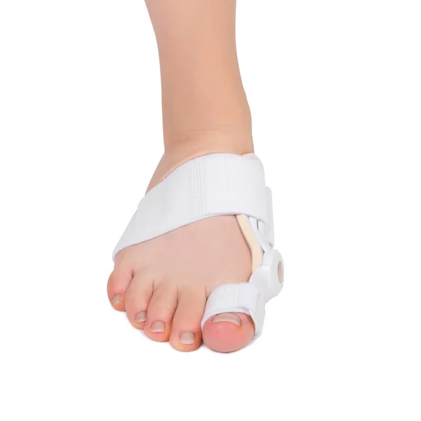 Spezieller Medizinischer Orthopädischer Verband Zur Nicht Chirurgischen Behandlung Einer Daumendeformität — Stockfoto