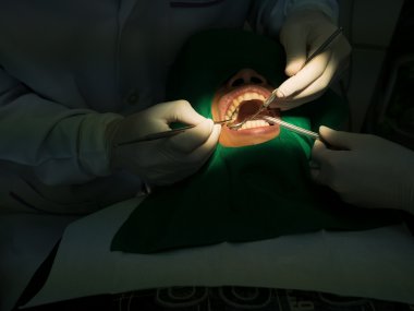 Diş hekimi doldurma