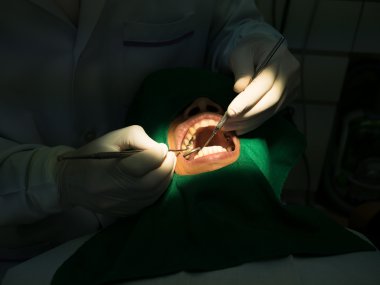 Diş hekimi doldurma