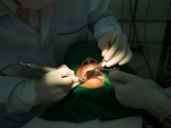 Riempimento dentista — Foto Stock