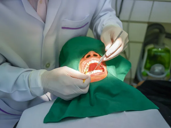 Dentist filling — Stock Photo, Image