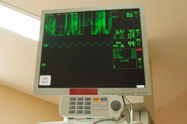 Intensive care afdeling monitor — Stockfoto