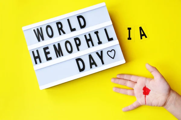 The inscription World Hemophilia Day. Is celebrated annually on April 17.  Hemophilia occurs due to gene mutations on the X chromosome and is inherited. It manifests in a violation of blood clotting. Child hand with red heart