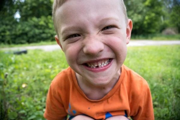 小さな子供が最初の歯を失い — ストック写真