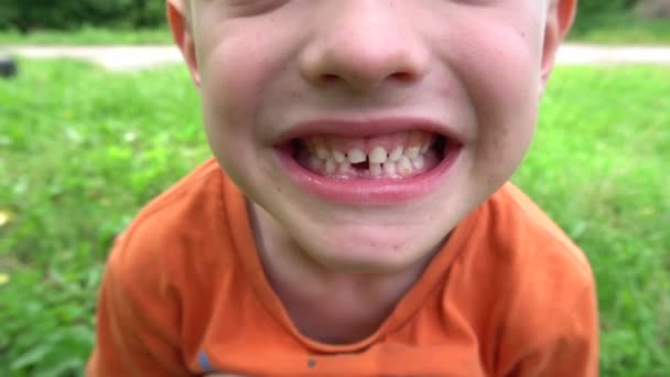 Μικρό Παιδί Έχασε Πρώτο Δόντι — Αρχείο Βίντεο