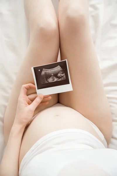 Young pregnant woman looking at ultrasound scan — Stock Photo, Image