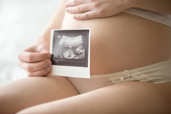 Young pregnant woman showing ultrasonic image of her baby — Stock fotografie