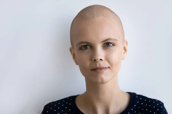 Head shot portrait unhealthy hairless woman on white background — Stock Photo, Image