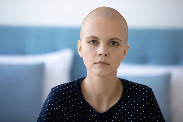 Retrato de la cabeza infeliz mujer joven sin pelo agotado con oncología — Foto de Stock