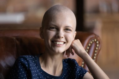 Kanepede oturan, gülmeyen tüysüz kadın iyileşmekten mutlu.