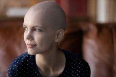 Kanepede oturan düşünceli kadın kanser hastası yan gelip düşünüyor.