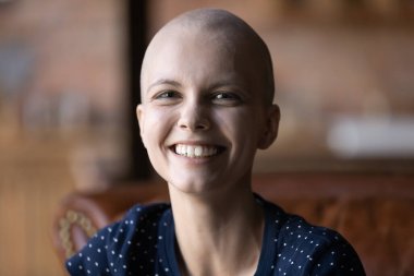 Tüysüz bir kadının kameraya bakıp gülümsediği bir portre.