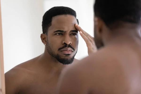 Stressad ung afrikansk amerikansk man känner sig missnöjd med hudåkomma. — Stockfoto